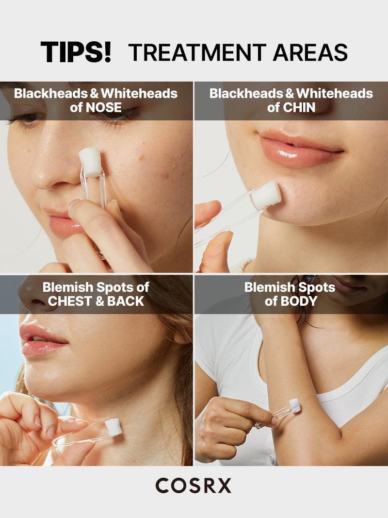 The AHA 2 BHA 2 Blemish Treatment Serum – COSRX Official