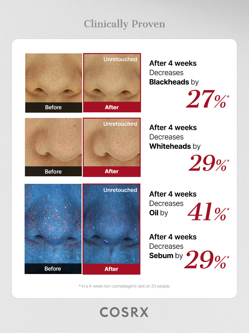 The AHA 2 BHA 2 Blemish Treatment Serum – COSRX Official