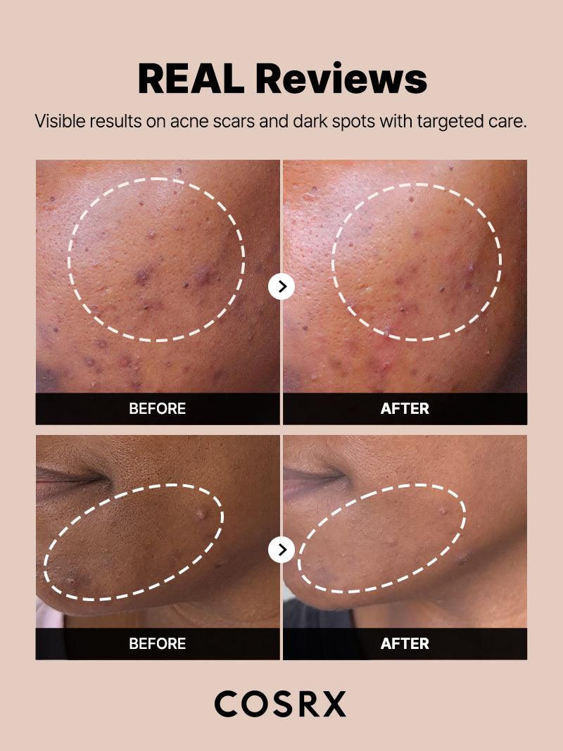 The Alpha-Arbutin 2 Discoloration Care Serum 2-Pack The Alpha-Arbutin 2 Discoloration Care Serum 2-Pack