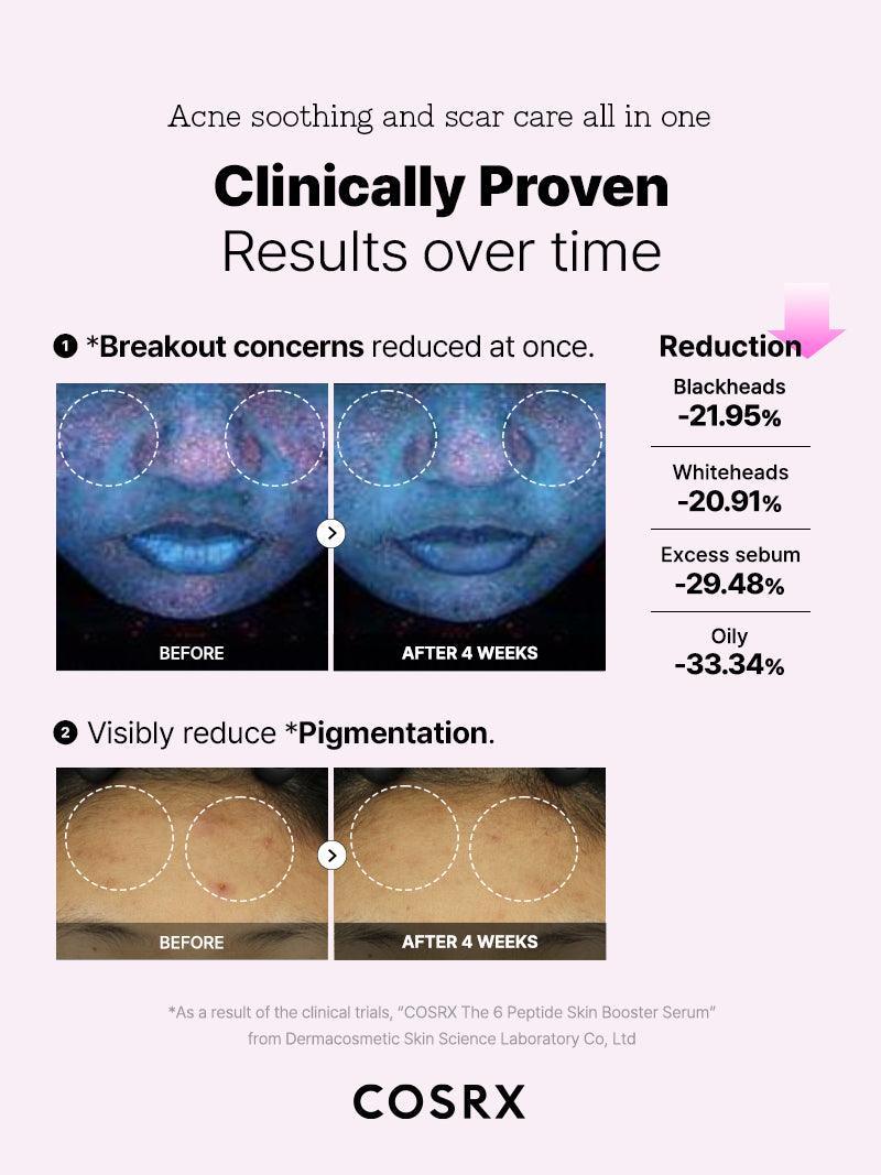 COSRX Peptide Brightening Boost | Firmness & Early Anti-Aging Care