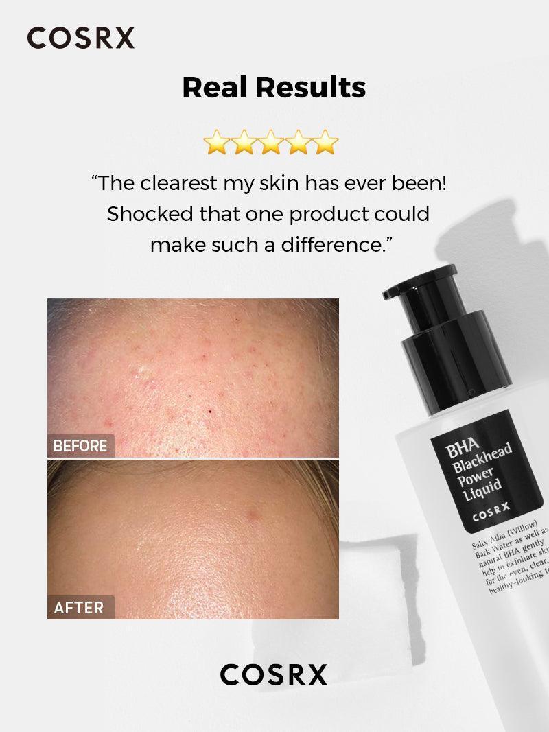 Cosrx Bha Blackhead Power Liquid - 100Ml 4 Cosrx Bha Blackhead Power Liquid - 100Ml Bha Blackhead Power Liquid Cosrx Official 4